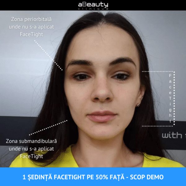 Pachet 2 ședințe, Tratament Facial Întinerire și Fermitate FaceTight, neinvaziv, Zona Submandibulară - imagine 16