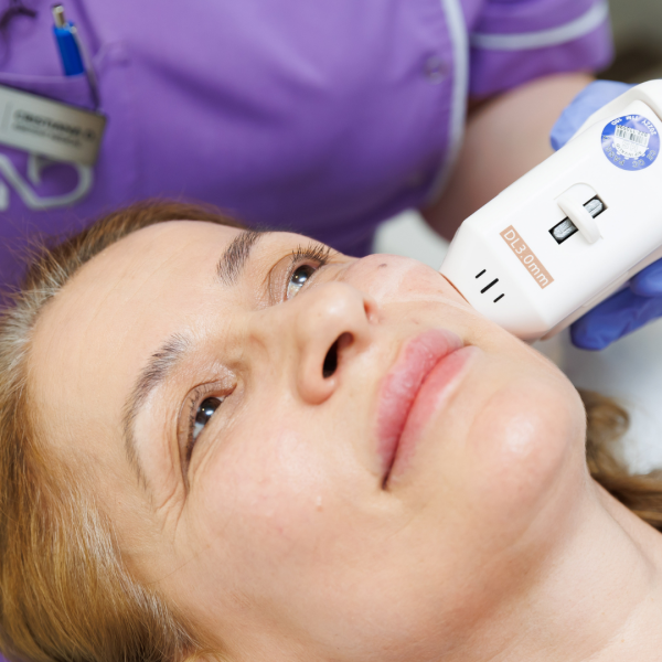Ședință de tratament de Lifting Facial neinvaziv FaceTight Zona Periorbitală