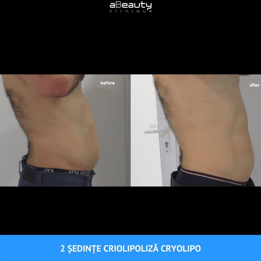 slabire brusca cauze talpi de slăbire