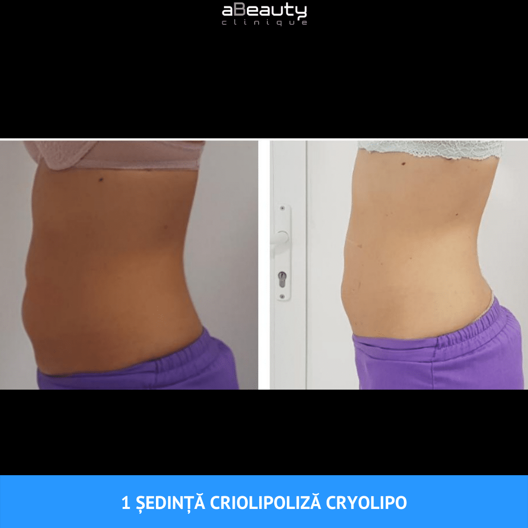 apuretin slim farmacia tei smoothie pentru slabit rapid