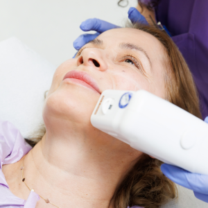 Ședință de tratament de Lifting Facial neinvaziv FaceTight Obraji