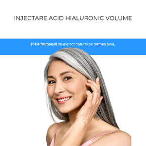 Injectare Acid Hialuronic Volume