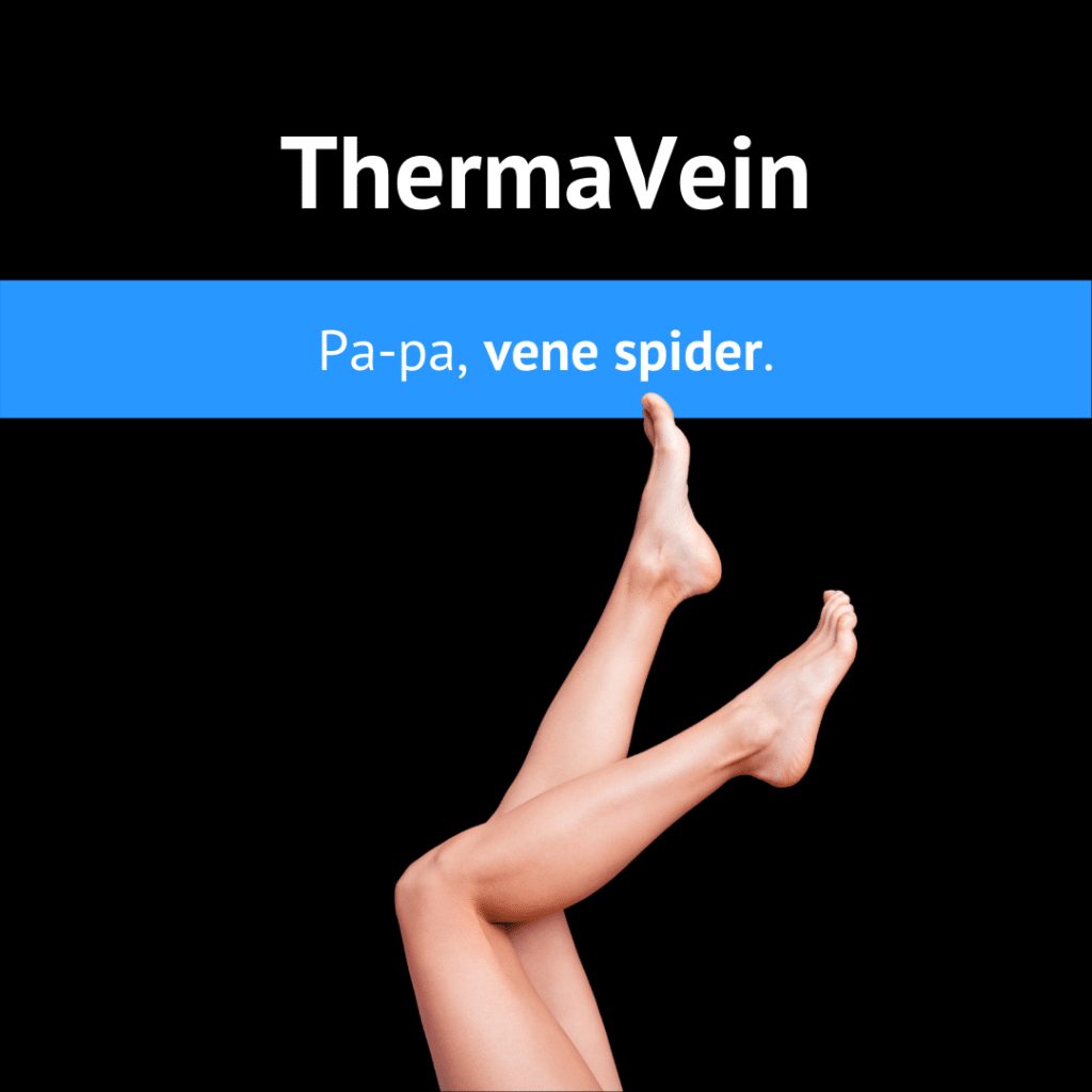 Produse - ThermaVein Vase Capilare 2