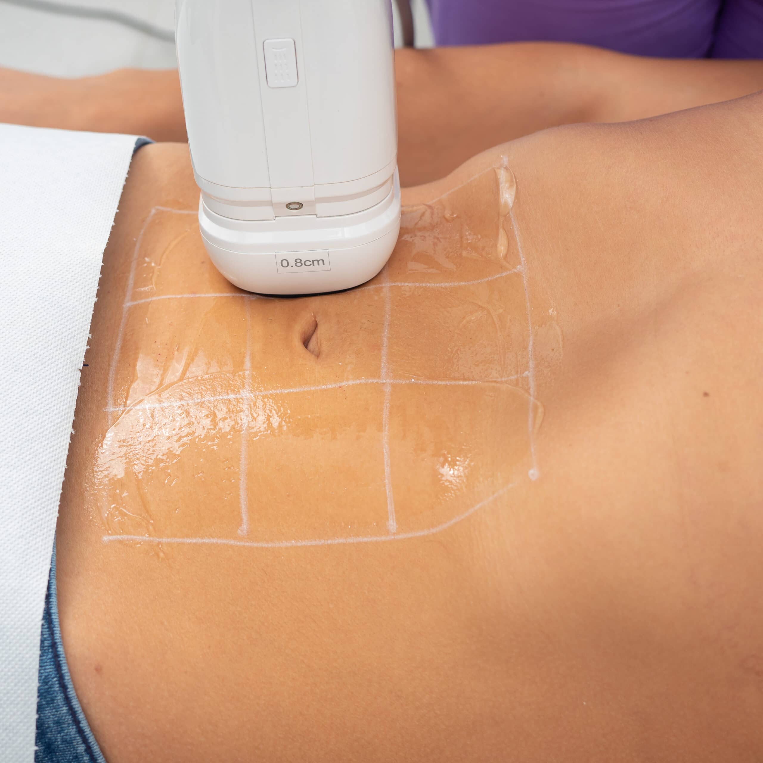 ceai de mere cu scortisoara pentru slabit grasimea abdominala remedii