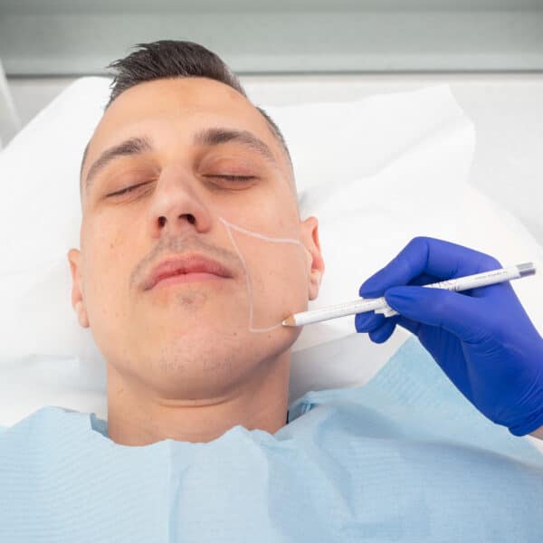 Pachet 2 ședințe, Tratament Facial Întinerire și Fermitate FaceTight, neinvaziv, Zona Submandibulară - imagine 6