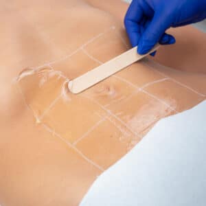 Terapii Slabire Barbati Abdomen