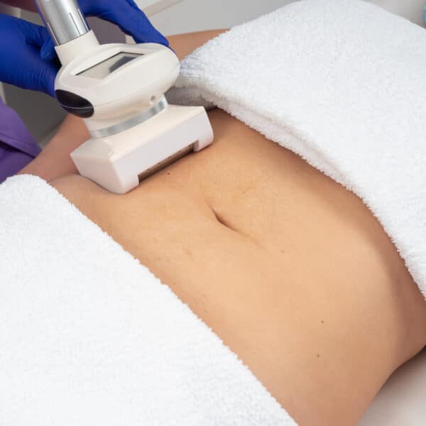 Tratament Burta BodyShape