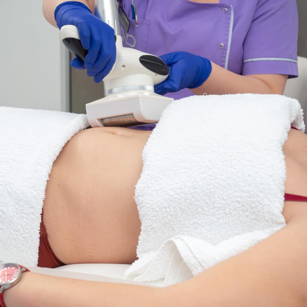 Tratament Corporal Slăbire Criolipoliză CryoLipo - aBeauty Clinique