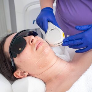 Epilare-Definitiva-Laser-Faciala-scaled