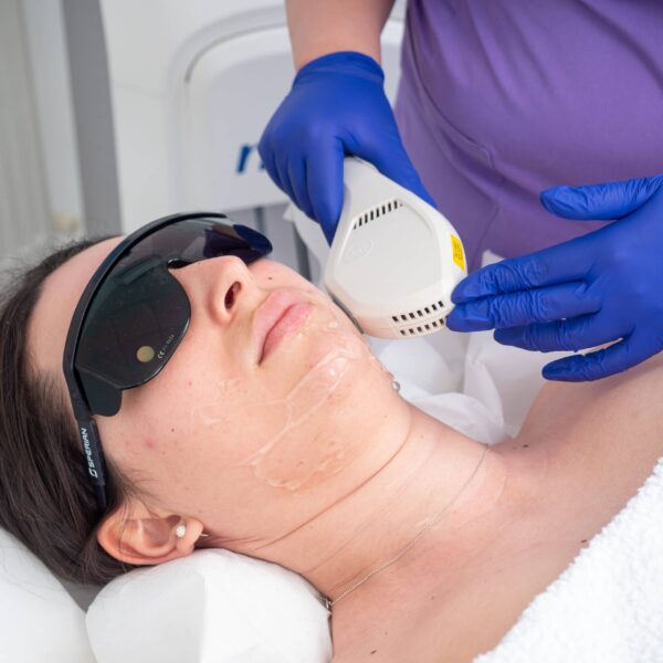 Epilare-Definitiva-Laser-Faciala-scaled