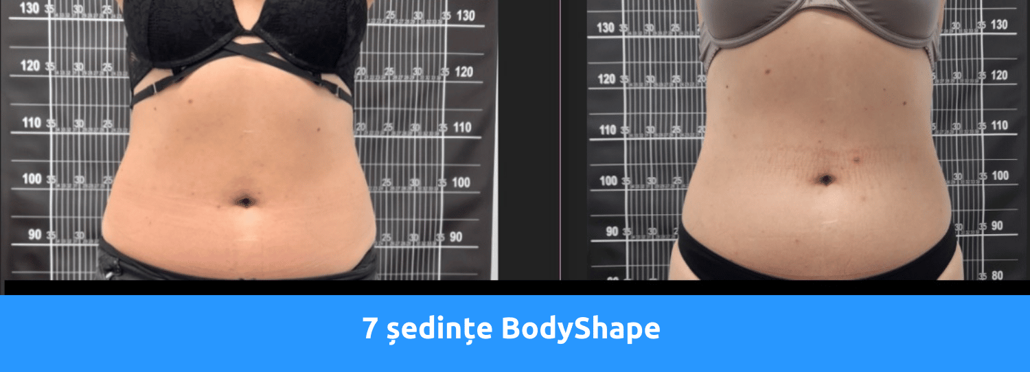 Rezultate Bodyshape