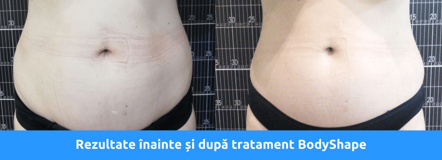 Rezultate Bodyshape