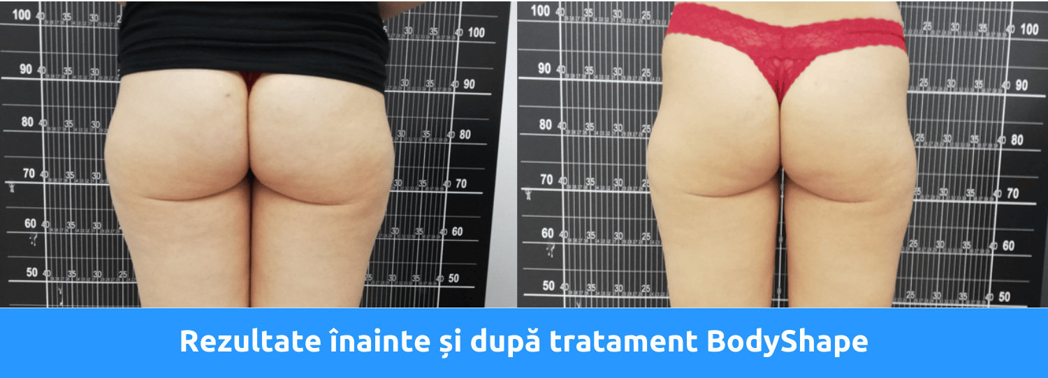 Rezultate Bodyshape