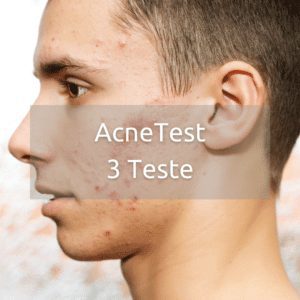 AcneTest 3 teste