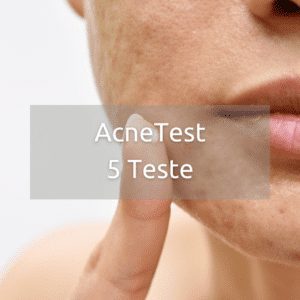 AcneTest 5 teste