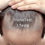 TrichoTest 3 teste