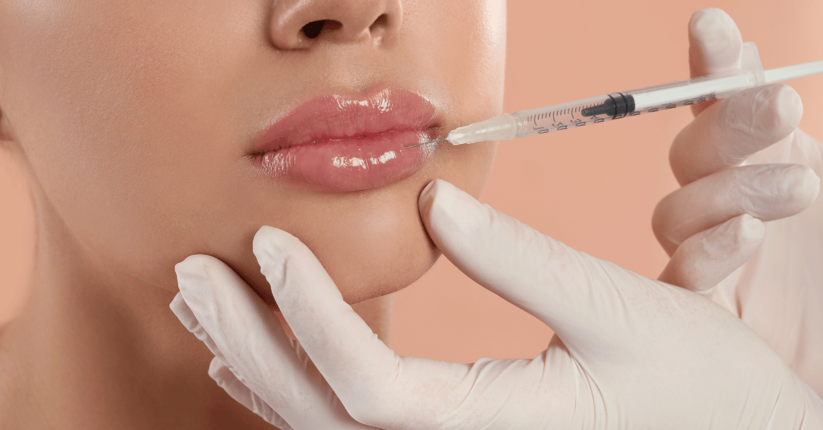 Despre injectarea buzelor cu acid hialuronic
