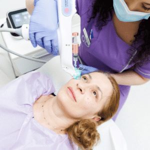 tratament facial cicatrici