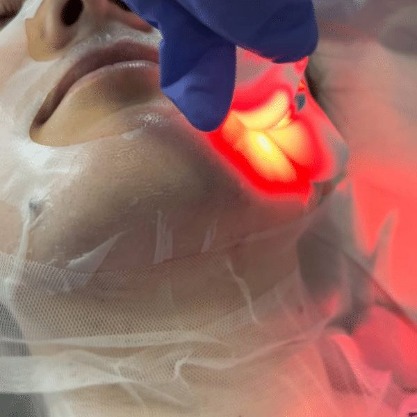 tratament refuvenare facială dermovisage