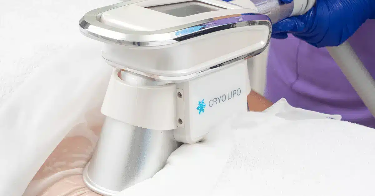 Criolipoliza-Craiova-Slabeste-Rapid-si-Sigur-cu-CryoLipo-la-aBeauty-Craiova