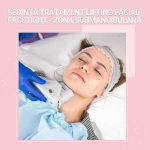 Ședință tratament Lifting Facial FaceTight - Zona Submandibulară