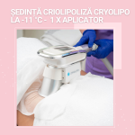 ședință Criolipoliză CryoLipo la -11 °C - 1 x Aplicator