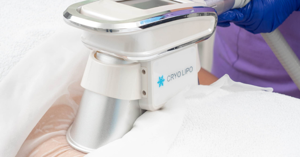 CryoLipo la aBeauty Timisoara