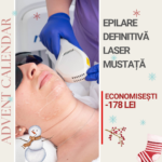 Epilare Definitivă Laser Mustață