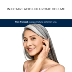 Injectare Acid Hialuronic Volume