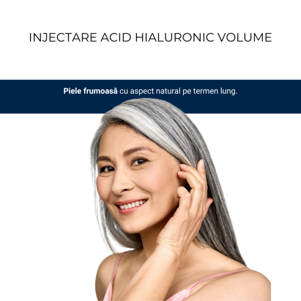 Injectare Acid Hialuronic Volume