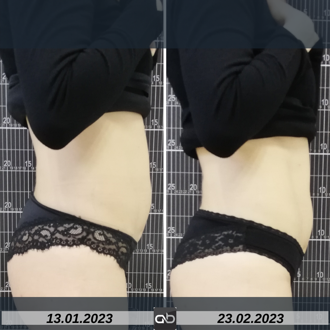 tratament tonifiere musculara DualFit