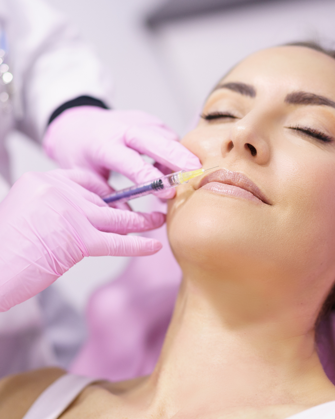 Injectare Riduri cu acid hialuronic
