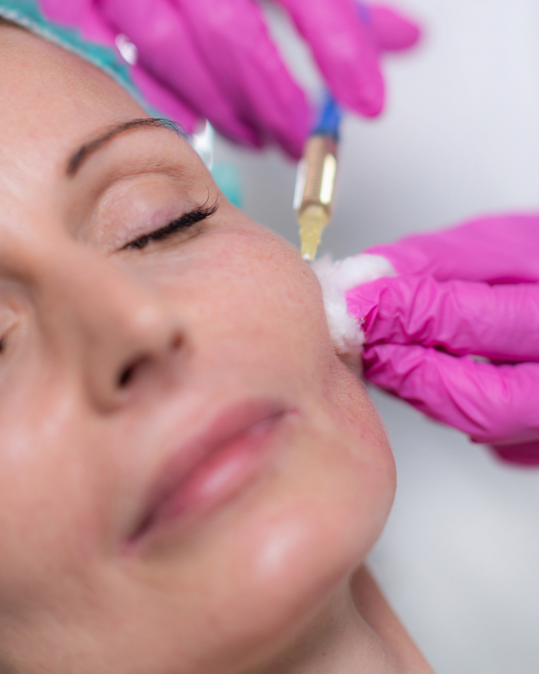 Injectare Volumetrie Facială